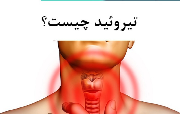 گواتر چیست و آیا ارثی است؟ + فیلم