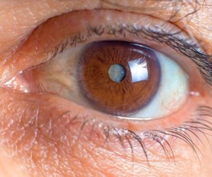 مراقبت از چشم‌ها به عنوان حساس‌ترین عضو بدن