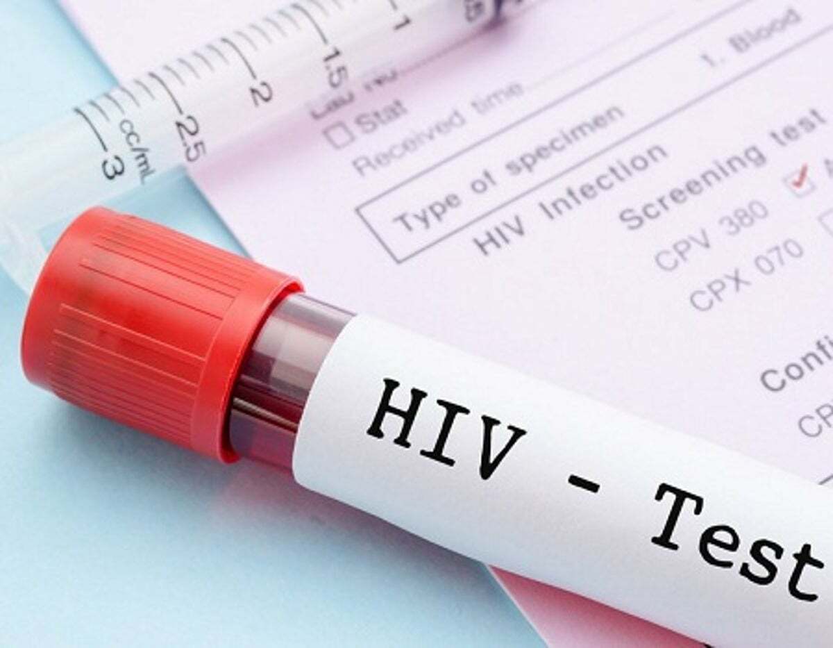 انجام تست HIV، اقدامی حیاتی برای حفظ سلامت فرد و جامعه انجام تست HIV، اقدامی حیاتی برای حفظ سلامت فرد و جامعه
